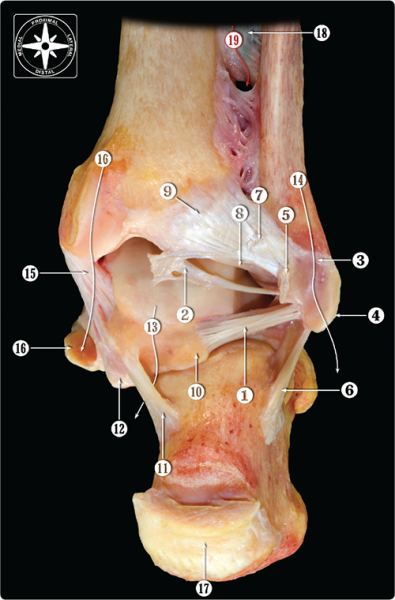 Anterior Talofibular Ligament Sprain